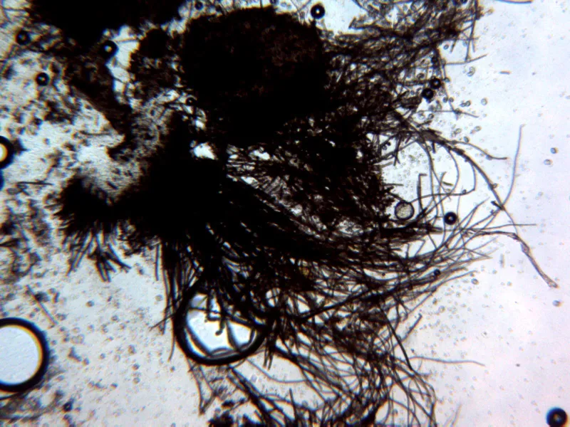 Chaetomium globosum 10 - X 100 1